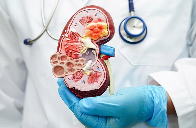 Dapagliflozin Safe and Effective in CKD Stages 4 and 5