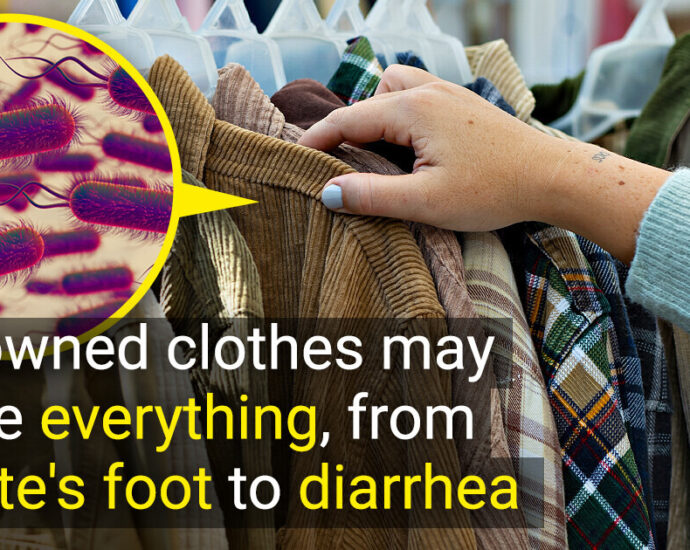 “They’re Swimming in Germs,” Scientists Give an Urgent Warning to Everyone Who Buys Vintage Second-Hand Clothes
