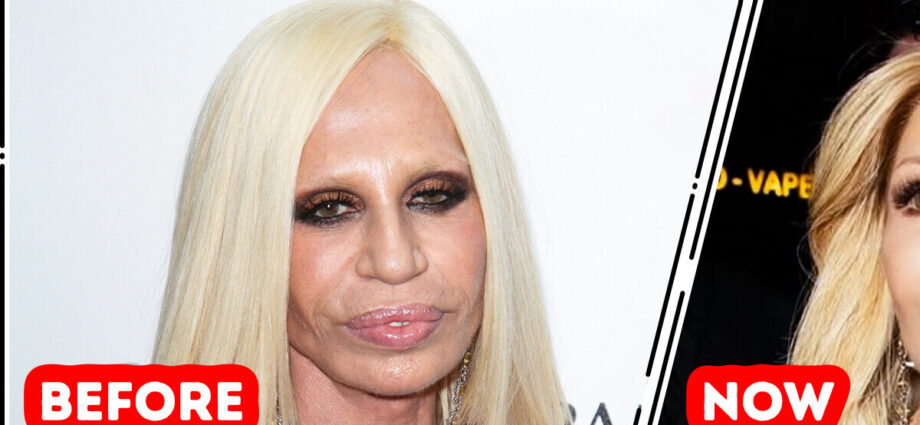 “This Is the Best She Has Looked in Decades!” New Look of Donatella Versace Creates Buzz