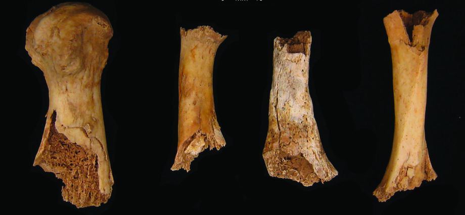 Bronze Age butchery and cannibalism unearthed in England