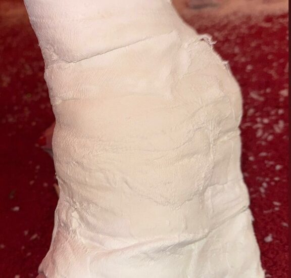 Kim Kardashian shows off her wild high-heeled cast: ‘Broken foot, but make it fashion’