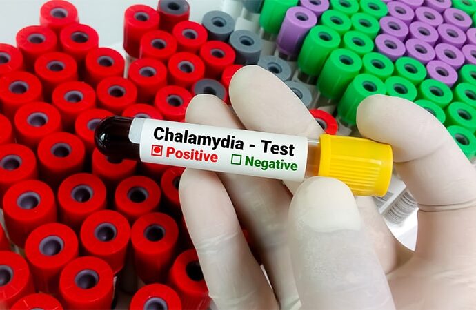 Doxycycline Kits Boost Chlamydia Treatment in ED