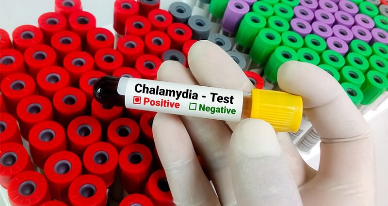 Doxycycline Kits Boost Chlamydia Treatment in ED