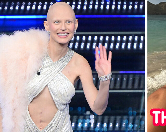 Victoria’s Secret Top Model Moves Everyone Showing Her Scar and Shaved Head at a Festival
