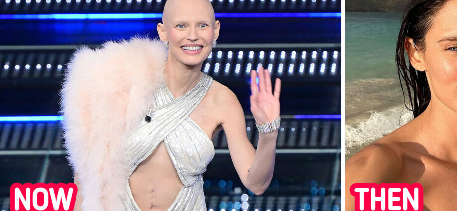 Victoria’s Secret Top Model Moves Everyone Showing Her Scar and Shaved Head at a Festival