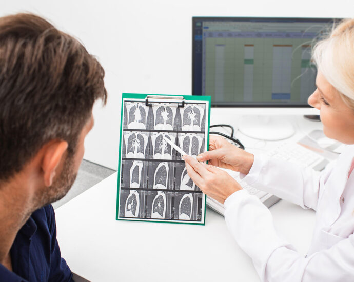 Lung Cancer Screening Rates Nearly 4 Times Lower Than Breast, Colon Cancers