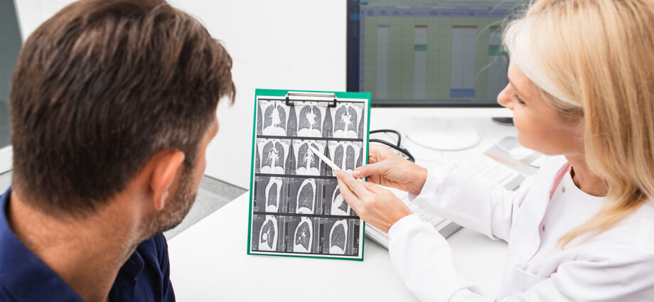Lung Cancer Screening Rates Nearly 4 Times Lower Than Breast, Colon Cancers