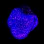 Organoid model integrates microglia to study inflammation in brain