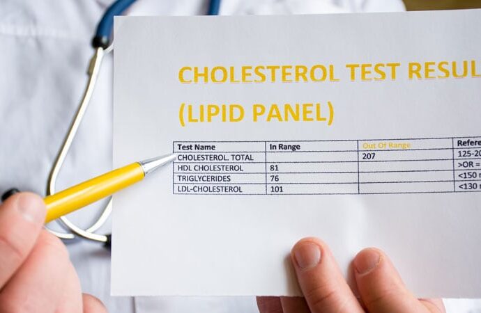 Lipid Level Variability Linked to Heart Failure Risk in T2D