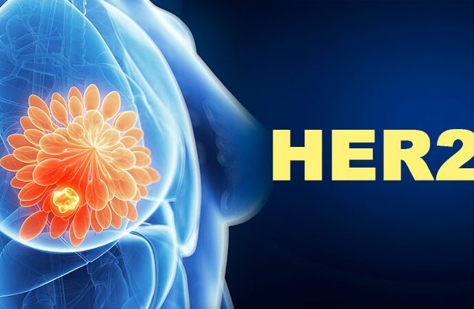 Which Tx Combo Is Best for HER2+ Breast Cancer?