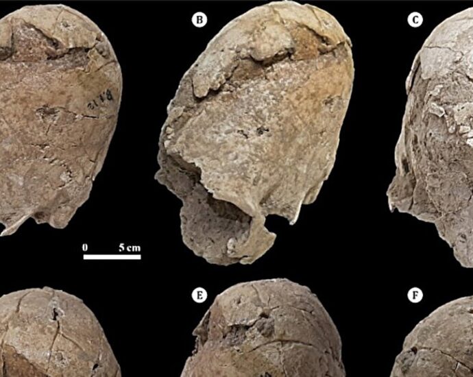 Ancient cone-shaped skull shows signs of fatal trauma