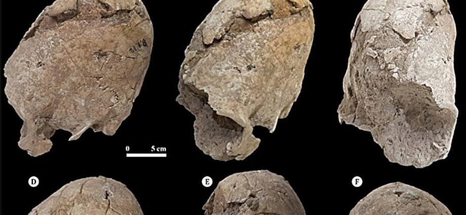Ancient cone-shaped skull shows signs of fatal trauma