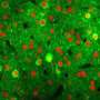 Neighborly help in the brain: Cerebral cortex networks rapidly reorganize to compensate for lost neurons