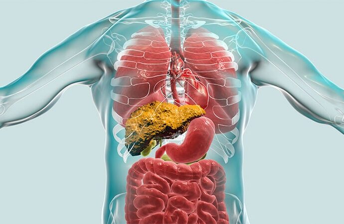 Preemptive TIPS Promising for Fundal Variceal Bleeding