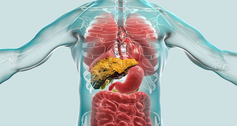 Preemptive TIPS Promising for Fundal Variceal Bleeding