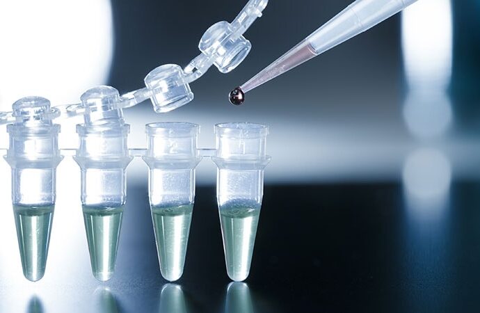 Stem Cell-Derived Islets Still Producing Insulin at 1 Year