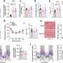 Study finds animal-based fats fuel tumor growth in obese mice, plant fats do not