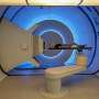 Radiation therapy can promote amphiregulin, which increases growth of metastases