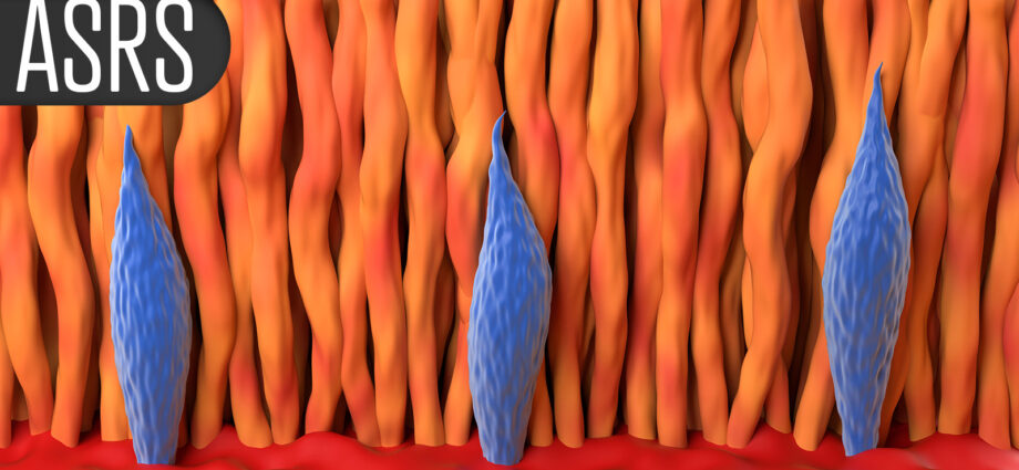 Combination Therapy for AMD Fails to Improve Vision Versus Single Drug