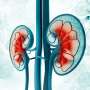 High metabolic syndrome severity linked to development of CKD
