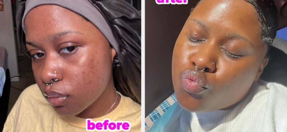 36 Products With Before And Afters That Will Simply Blow Your Mind