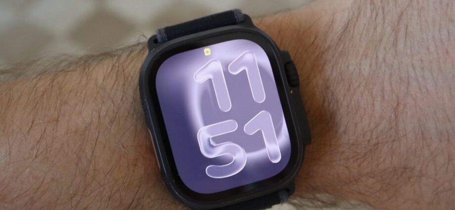 watchOS 26 Review: More Reliant On The iPhone Than Ever