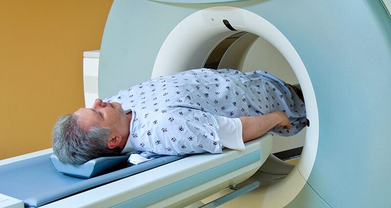 Can PSMA PET/CT Improve Prostate Cancer Staging and Care?