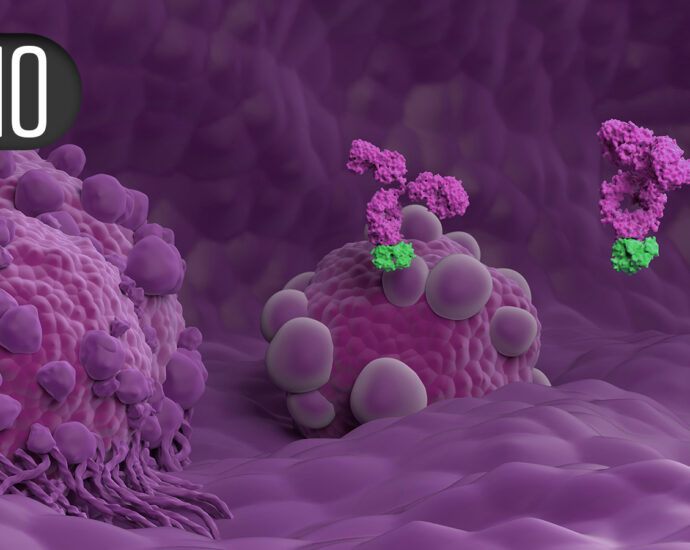 Trastuzumab Deruxtecan Scores Two Wins in HER2-Positive Early Breast Cancer