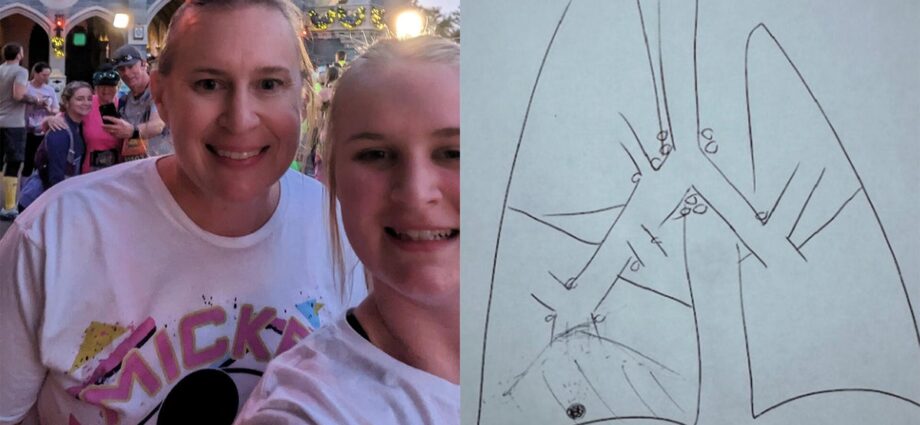 Broken limb leads to non-smoker’s lung cancer diagnosis years later