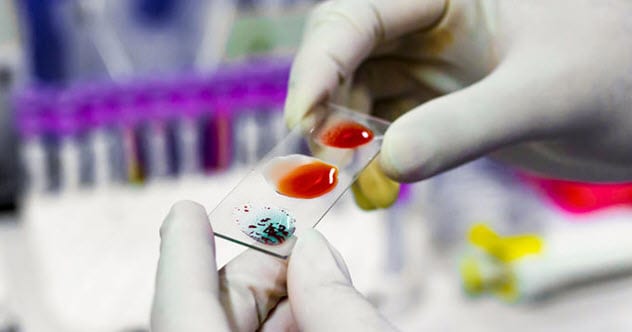 10 Things So Rare They’ve Only Been Found Once