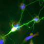 Natural protein drug may slow neuron death linked to Alzheimer’s disease