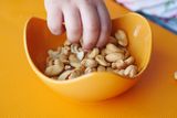 Lower Doses of Peanut Immunotherapy Could Make Allergy Treatment More Accessible