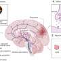 Procrastination in adulthood linked to brain development during adolescence