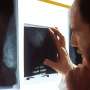 Low-field MRI is safe, feasible and more comfortable for breast screening, finds study