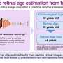 AI can use a photo of the eye to estimate retinal age, flag risk for major diseases
