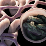 Showering Protocol for Hemodialysis Patients Shows No Increased Infection Risk
