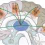 Psychedelics amplify brain connectivity through serotonin receptors, study suggests