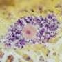 Macrophage ‘molecular scissors’ may drive obesity-linked inflammation and metabolic damage