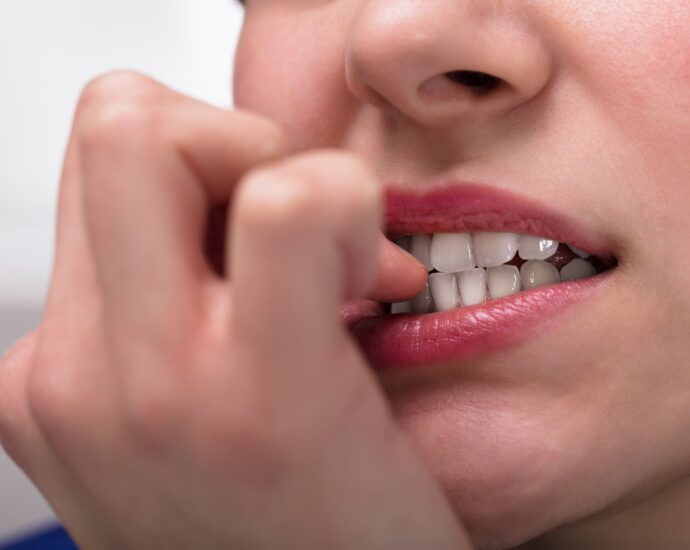 How gross is biting your fingernails?