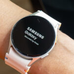Galaxy Watch Owners Report Disturbing Marks On Wrists